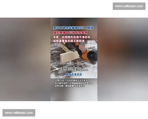 羽毛球击中眼球险致失明！25 岁小伙紧急救治保住视力